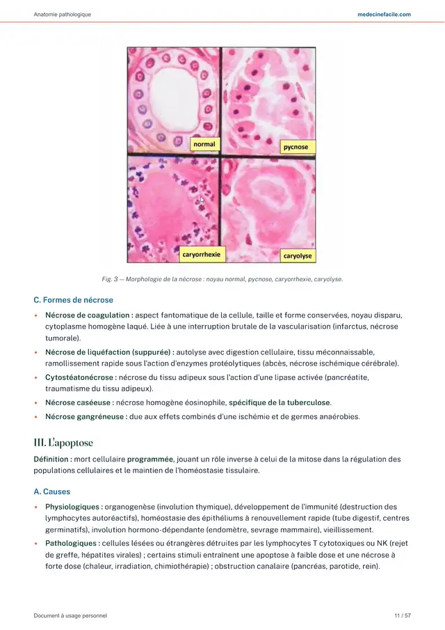 Anatomie pathologique — page 11