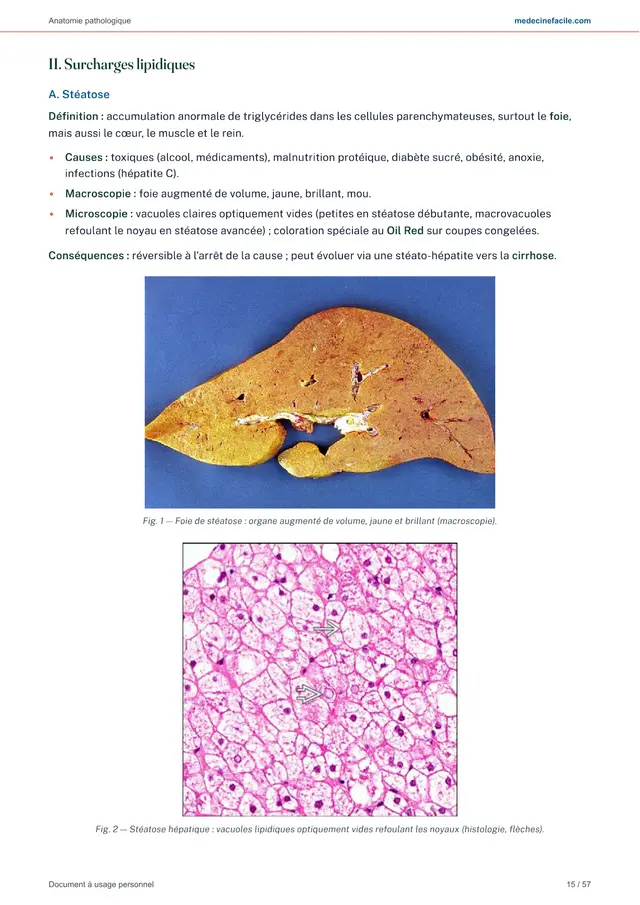 Anatomie pathologique — page 15