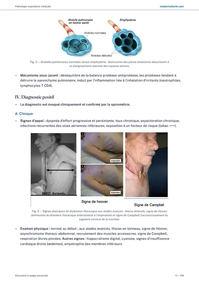 Pathologie respiratoire — page 11
